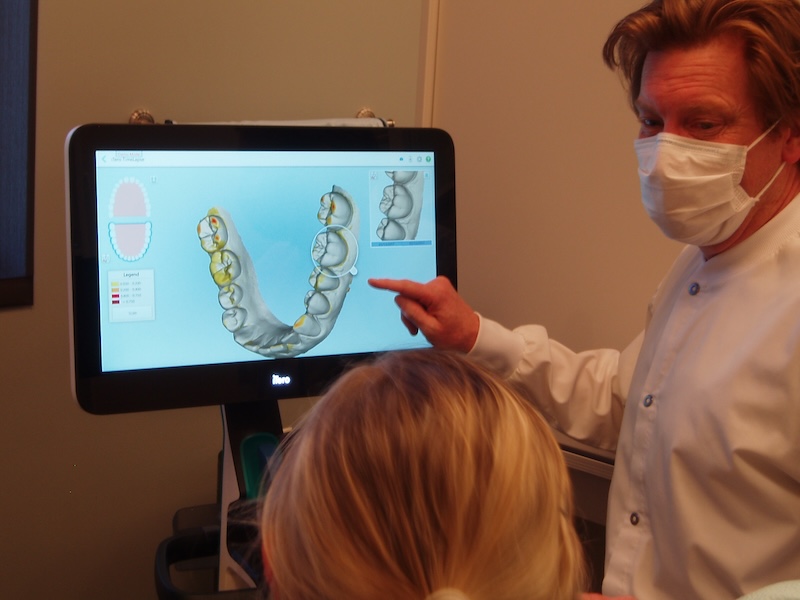 A photo of Dr Brian demonstrating to a patient how the iTero scanner can monitor movement